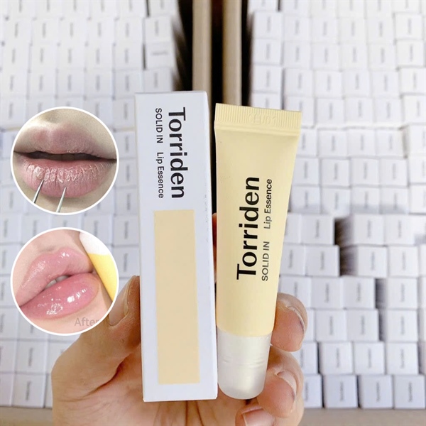 Son Dưỡng Torriden