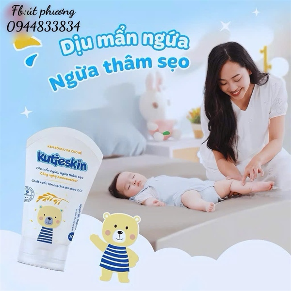 KEM BÔI DỊU DA KUTIESKIN 30G
