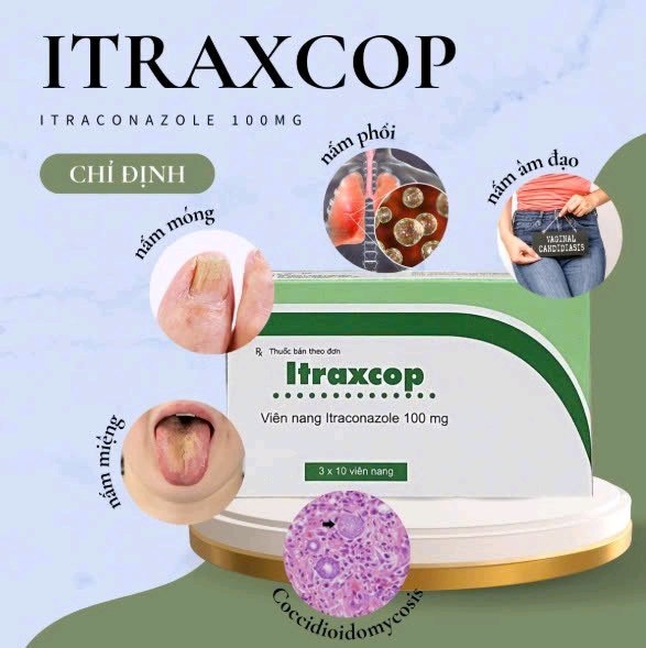 Thuốc Itraxcop (Itraconazole100mg) điều trị các bệnh nhiễm nấm da, nấm móng, nấm Candida (Hộp 3 vỉ x 10 viên) (Hộp)