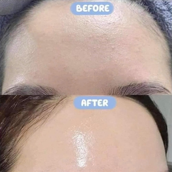Tinh chất phục hồi da Smas Premium Cica Recovery Serum 120ml tại shipnhanh