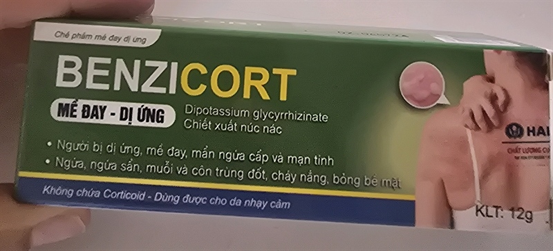 Benzicort 12g mề đay,dị ứng