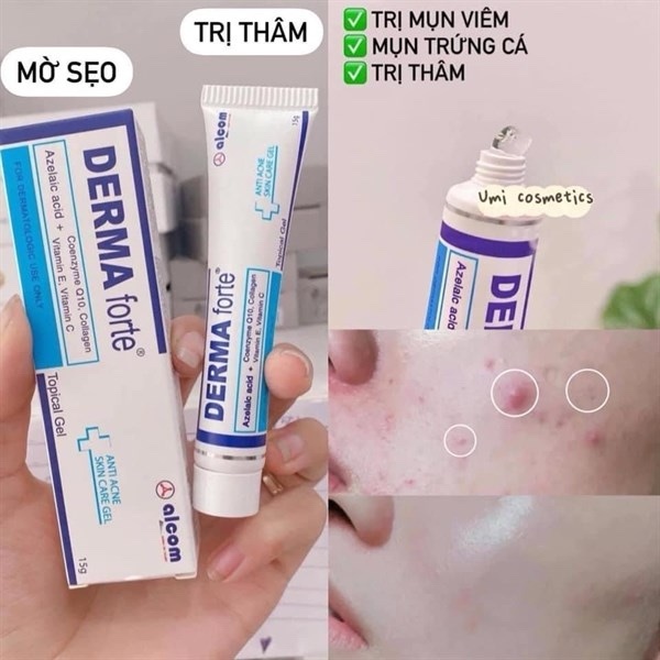 Kem trị mụn derma forte 15g