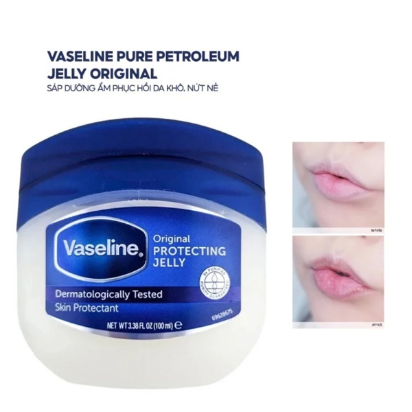 [ Hàng công ty] VASELINE Sáp Dưỡng Ẩm 5.5g