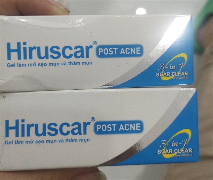 Hiruscar post acne