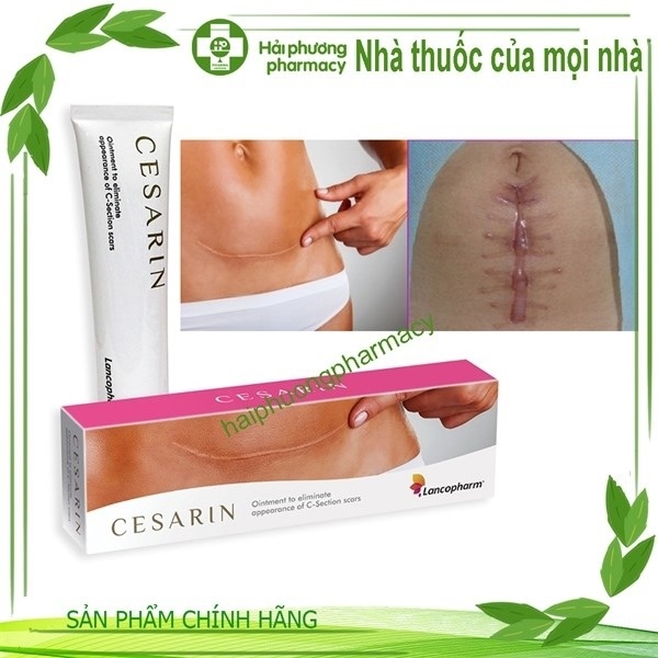 Kem sẹo phẫu thuật Cesarin